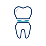 Cementation