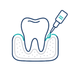 Periodontal Treatment Materials