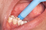 Flex Saliva Ejector - Image 5