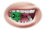 Rest Mouth - Image 5