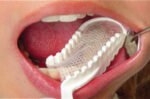 Moldex Impression Tray - Image 6