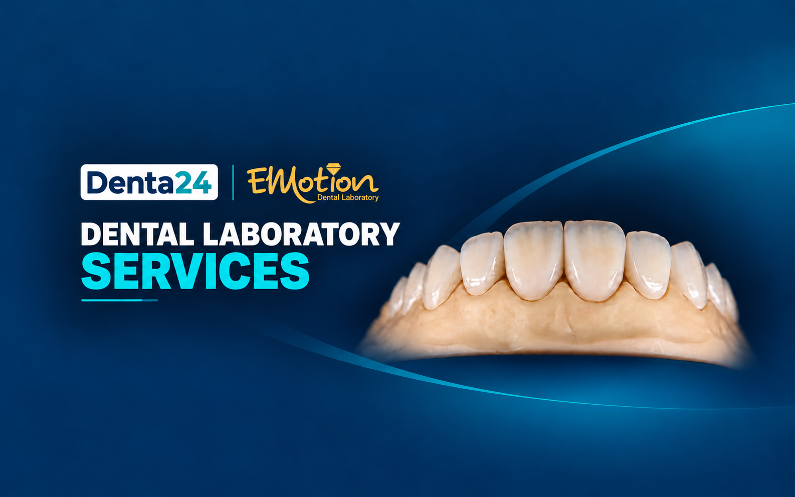 Denta24 and Emotion dental laboratory services featuring anterior restorations on a dental model banner