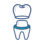Prosthodontic Materials