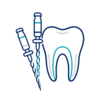 Endodontic Rotary Files
