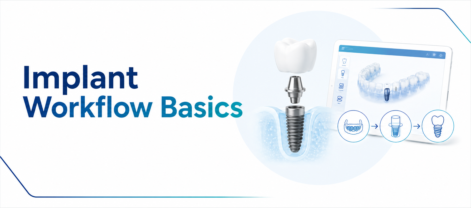 Implant Workflow Basics